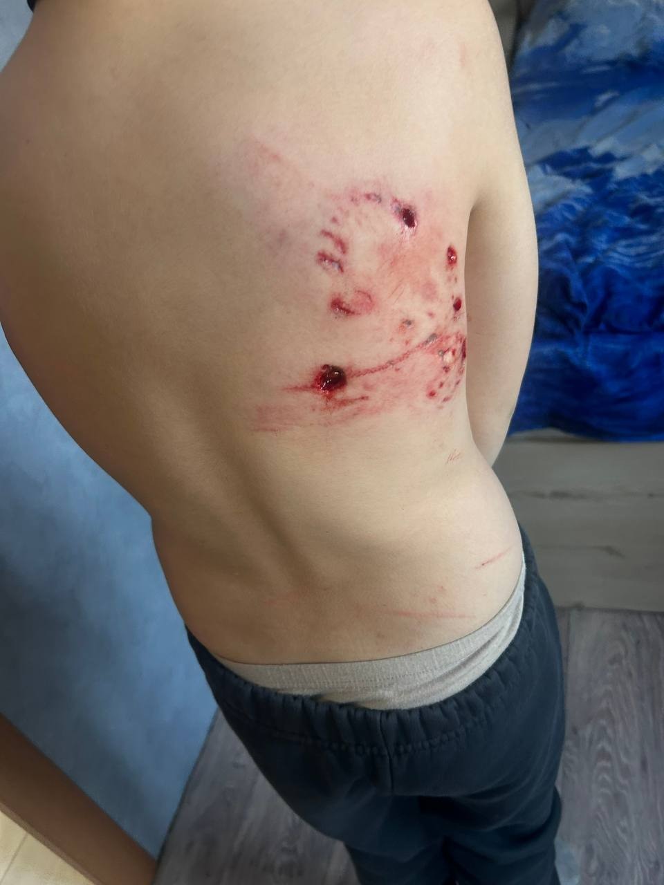 После нападения собаки на ребёнка в Кулебаках возбуждено уголовное дело о халатности